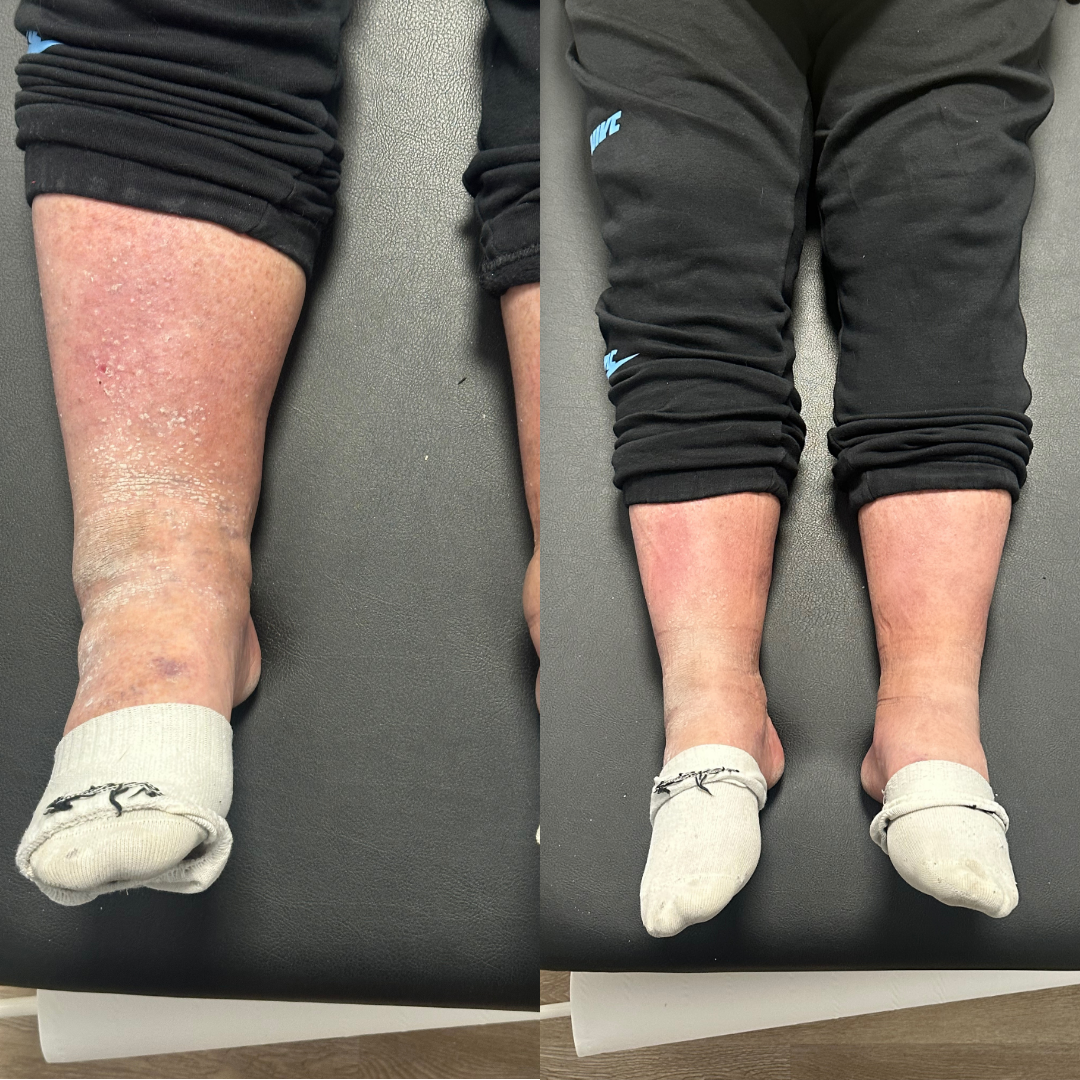 ZENOVA® Pressothérapie - Pack PREMIUM