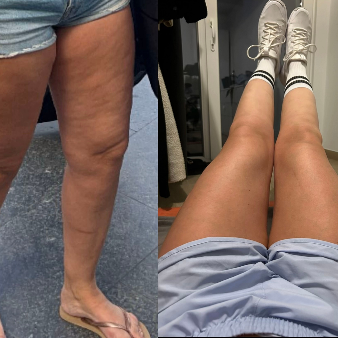 ZENOVA® Pressothérapie - Pack PREMIUM