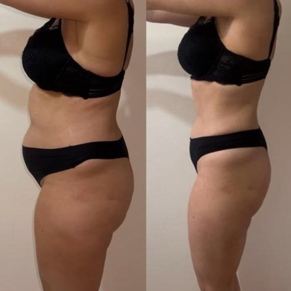 Accessoires Premium de Pressothérapie – ZENOVA®