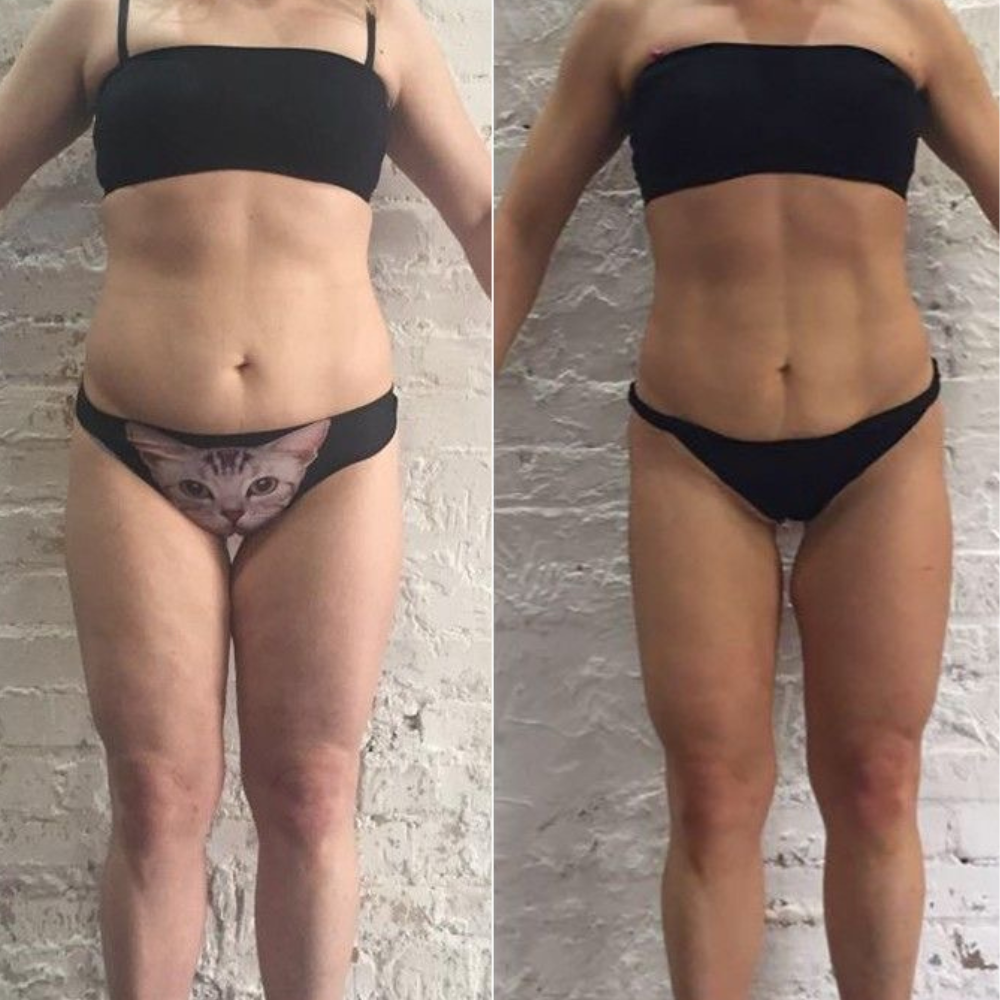 Accessoires Premium de Pressothérapie – ZENOVA®