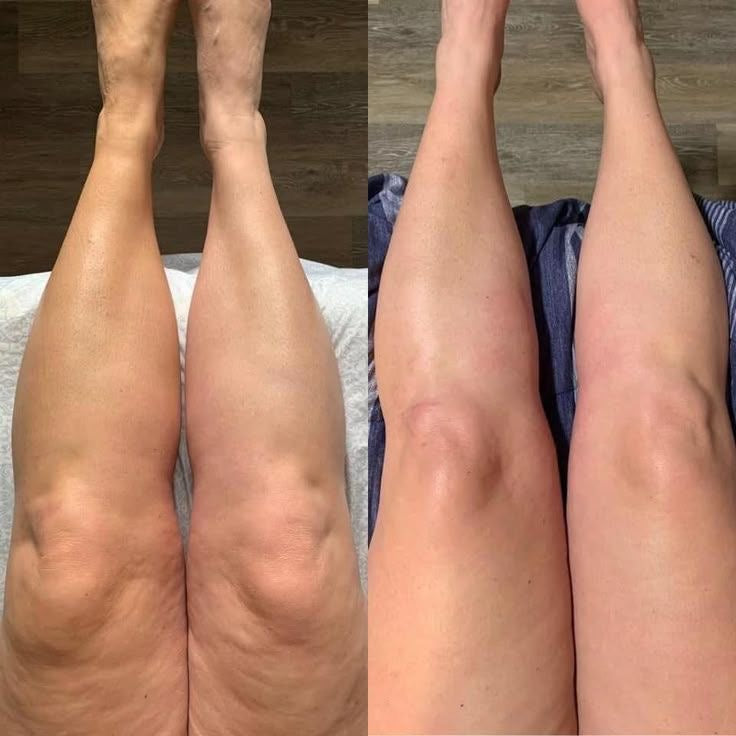 ZENOVA® – Bottes de pressothérapie à domicile | Jambes légères & affinées